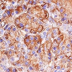 Invitrogen Trypsin Polyclonal Antibody 100 &mu;g; Unconjugated:Antibodies,