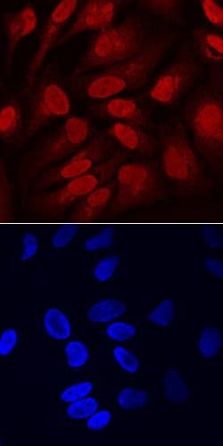 Invitrogen SOX11 Polyclonal Antibody 100 &mu;g; Unconjugated:Antibodies,