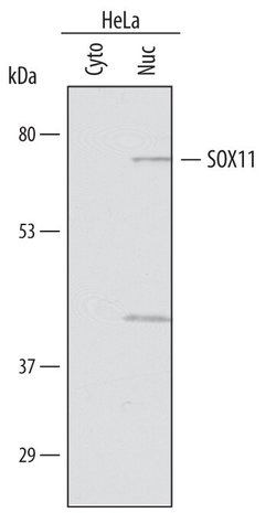 Invitrogen SOX11 Polyclonal Antibody 100 &mu;g; Unconjugated:Antibodies,