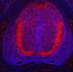 Invitrogen PLXNA3 Polyclonal Antibody 100 &mu;g; Unconjugated:Antibodies,