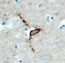 Invitrogen HAPLN4 Polyclonal Antibody 100 &mu;g; Unconjugated:Antibodies,