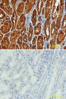Invitrogen Renin Polyclonal Antibody 100 &mu;g; Unconjugated:Antibodies,