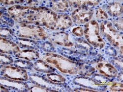 Invitrogen Renin Polyclonal Antibody 100 &mu;g; Unconjugated:Antibodies,