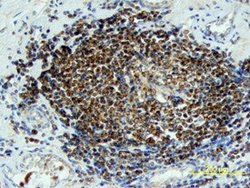 Invitrogen WNT6 Polyclonal Antibody 100 &mu;g; Unconjugated:Antibodies,