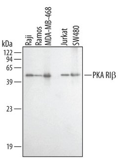 Invitrogen PRKAR1B Polyclonal Antibody 100 &mu;g | Buy Online | Invitrogen&trade; | Fisher Scientific