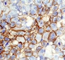 Invitrogen CD109 Polyclonal Antibody 100 &mu;g; Unconjugated:Antibodies,