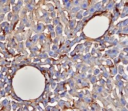 Invitrogen CD39 Polyclonal Antibody 100 &mu;g; Unconjugated:Antibodies,