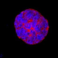 Invitrogen ESGP Polyclonal Antibody 100 &mu;g; Unconjugated:Antibodies,