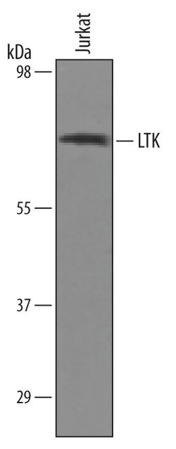Invitrogen LTK Polyclonal Antibody 100 &mu;g | Buy Online | Invitrogen&trade; | Fisher Scientific