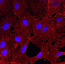 Invitrogen CLEC14A Polyclonal Antibody 100 &mu;g; Unconjugated:Antibodies,