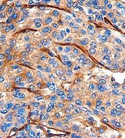 Invitrogen CLEC14A Polyclonal Antibody 100 &mu;g; Unconjugated:Antibodies,
