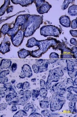 Invitrogen 5T4 Polyclonal Antibody 100 &mu;g; Unconjugated:Antibodies,
