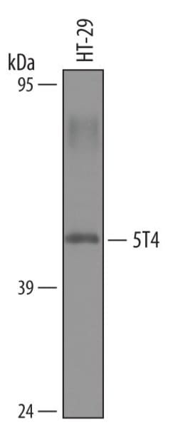 Invitrogen 5T4 Polyclonal Antibody 100 &mu;g; Unconjugated:Antibodies,