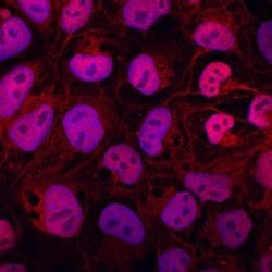 Invitrogen ZIC1 Polyclonal Antibody 100 &mu;g | Buy Online | Invitrogen&trade; | Fisher Scientific