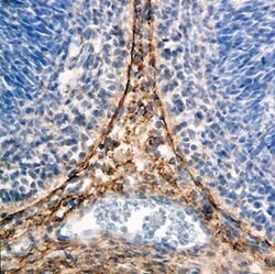 Invitrogen ZIC1 Polyclonal Antibody 100 &mu;g | Buy Online | Invitrogen&trade; | Fisher Scientific