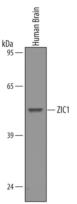 Invitrogen ZIC1 Polyclonal Antibody 100 &mu;g | Buy Online | Invitrogen&trade; | Fisher Scientific