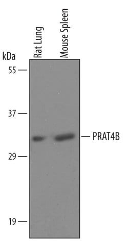 Invitrogen Cnpy4 Polyclonal Antibody 100 &mu;g; Unconjugated:Antibodies,