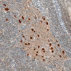 Invitrogen LRRC3 Polyclonal Antibody 100 &mu;g; Unconjugated:Antibodies,