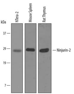Invitrogen Ninjurin 2 Polyclonal Antibody 100 &mu;g; Unconjugated:Antibodies,