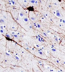 Invitrogen Parvalbumin Polyclonal Antibody 100 &mu;g; Unconjugated:Antibodies,