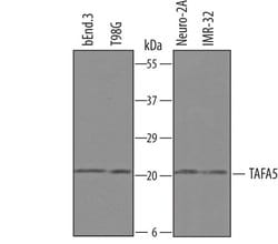 TAFA5 Polyclonal Antibody, Invitrogen 100 &mu;g; Unconjugated:Antibodies,