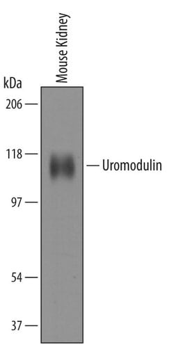 Invitrogen Uromodulin Polyclonal Antibody 100 &mu;g | Buy Online | Invitrogen&trade; | Fisher Scientific