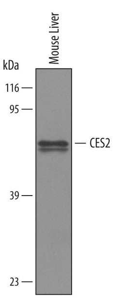 Invitrogen CES2 Polyclonal Antibody 100 &mu;g; Unconjugated:Antibodies,