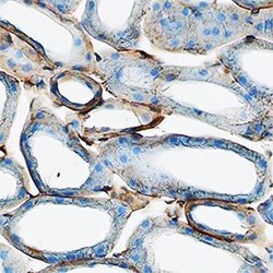 Invitrogen uPAR Polyclonal Antibody 100 &mu;g; Unconjugated:Antibodies,