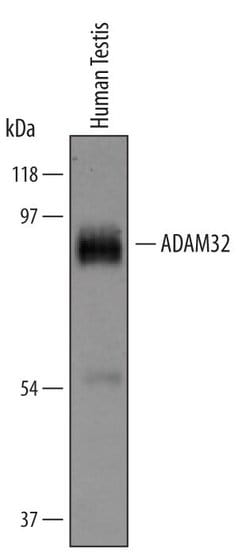 Invitrogen ADAM32 Polyclonal Antibody 100 &mu;g | Buy Online | Invitrogen&trade; | Fisher Scientific