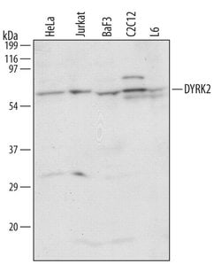Invitrogen DYRK2 Polyclonal Antibody 100 &mu;g; Unconjugated:Antibodies,