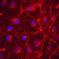 Invitrogen Plexin A2 Polyclonal Antibody 100 &mu;g; Unconjugated:Antibodies,