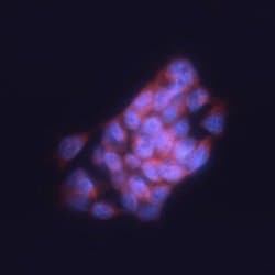 Invitrogen SLAIN1 Polyclonal Antibody 100 &mu;g; Unconjugated:Antibodies,