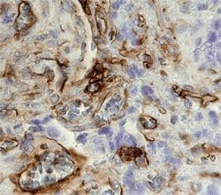 Invitrogen CD49a Polyclonal Antibody 100 &mu;g; Unconjugated:Antibodies,