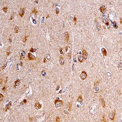 Invitrogen SORL1 Polyclonal Antibody 100 &mu;g; Unconjugated:Antibodies,