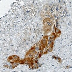 Invitrogen BTF3 Polyclonal Antibody 100 &mu;g; Unconjugated:Antibodies,