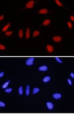 Invitrogen ING1 Polyclonal Antibody 100 &mu;g; Unconjugated:Antibodies,