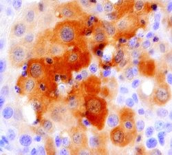 Invitrogen ING1 Polyclonal Antibody 100 &mu;g; Unconjugated:Antibodies,