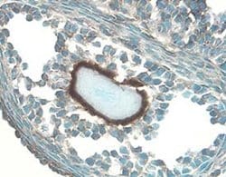 Invitrogen IGFBP5 Polyclonal Antibody 100 &mu;g; Unconjugated:Antibodies,