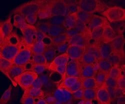 Invitrogen SULT2A1 Polyclonal Antibody 100 &mu;g; Unconjugated:Antibodies,