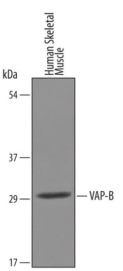 Invitrogen VAPB Polyclonal Antibody 100 &mu;g; Unconjugated:Antibodies,