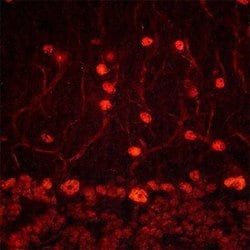 ADNP Polyclonal Antibody, Invitrogen 100 &mu;g | Buy Online | Invitrogen | Fisher Scientific