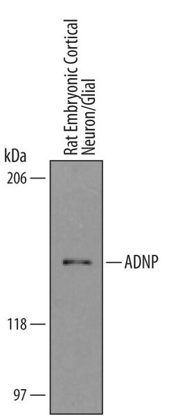 ADNP Polyclonal Antibody, Invitrogen 100 &mu;g | Buy Online | Invitrogen | Fisher Scientific