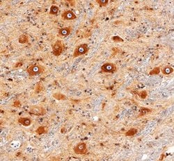 LRP4 Polyclonal Antibody:Antibodies, Polyclonal