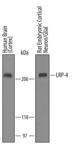 LRP4 Polyclonal Antibody:Antibodies, Polyclonal