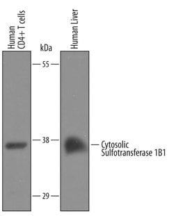 Invitrogen SULT1B1 Polyclonal Antibody 100 &mu;g; Unconjugated:Antibodies,