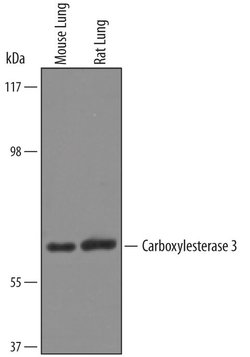 Invitrogen CES3 Polyclonal Antibody 100 &mu;g; Unconjugated:Antibodies,