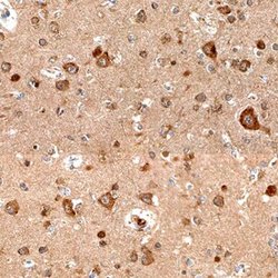 Invitrogen SEMA4C Polyclonal Antibody 100 &mu;g; Unconjugated:Antibodies,