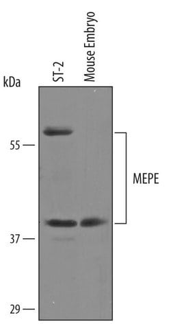 Invitrogen MEPE Polyclonal Antibody 100 &mu;g; Unconjugated:Antibodies,