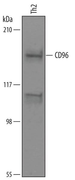 Invitrogen CD96 Polyclonal Antibody 100 &mu;g; Unconjugated:Antibodies,