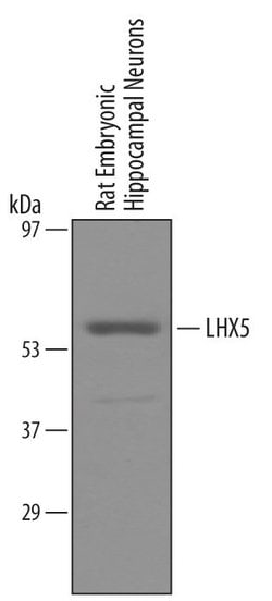Invitrogen LHX5 Polyclonal Antibody 100 &mu;g | Buy Online | Invitrogen&trade; | Fisher Scientific